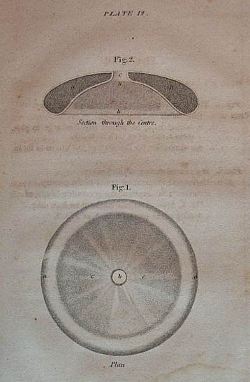 antique medical instrument called a pessary